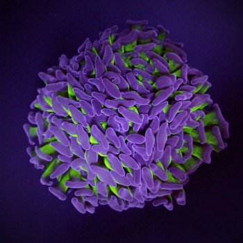 Euphyllia paraancora (Two...
